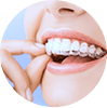 braces seven